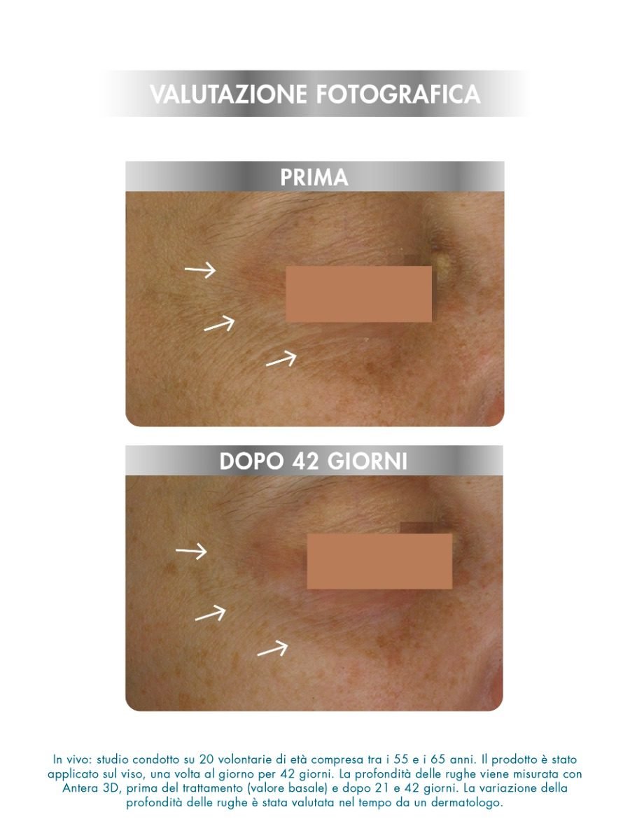 Age Reverse Masque میامو - تصویر ۲