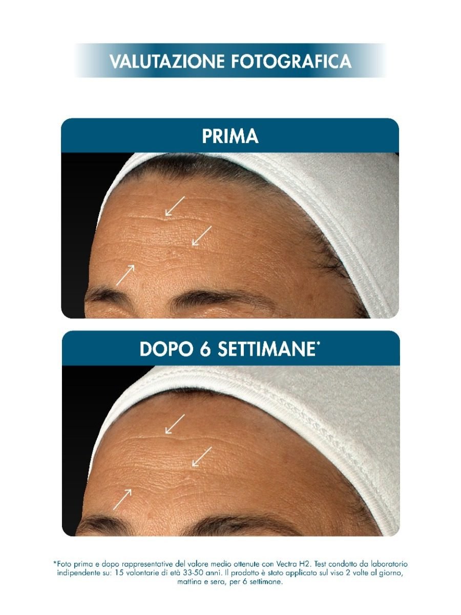 Poli-Hyaluronic 14+ Fusion Cream میامو - تصویر ۶